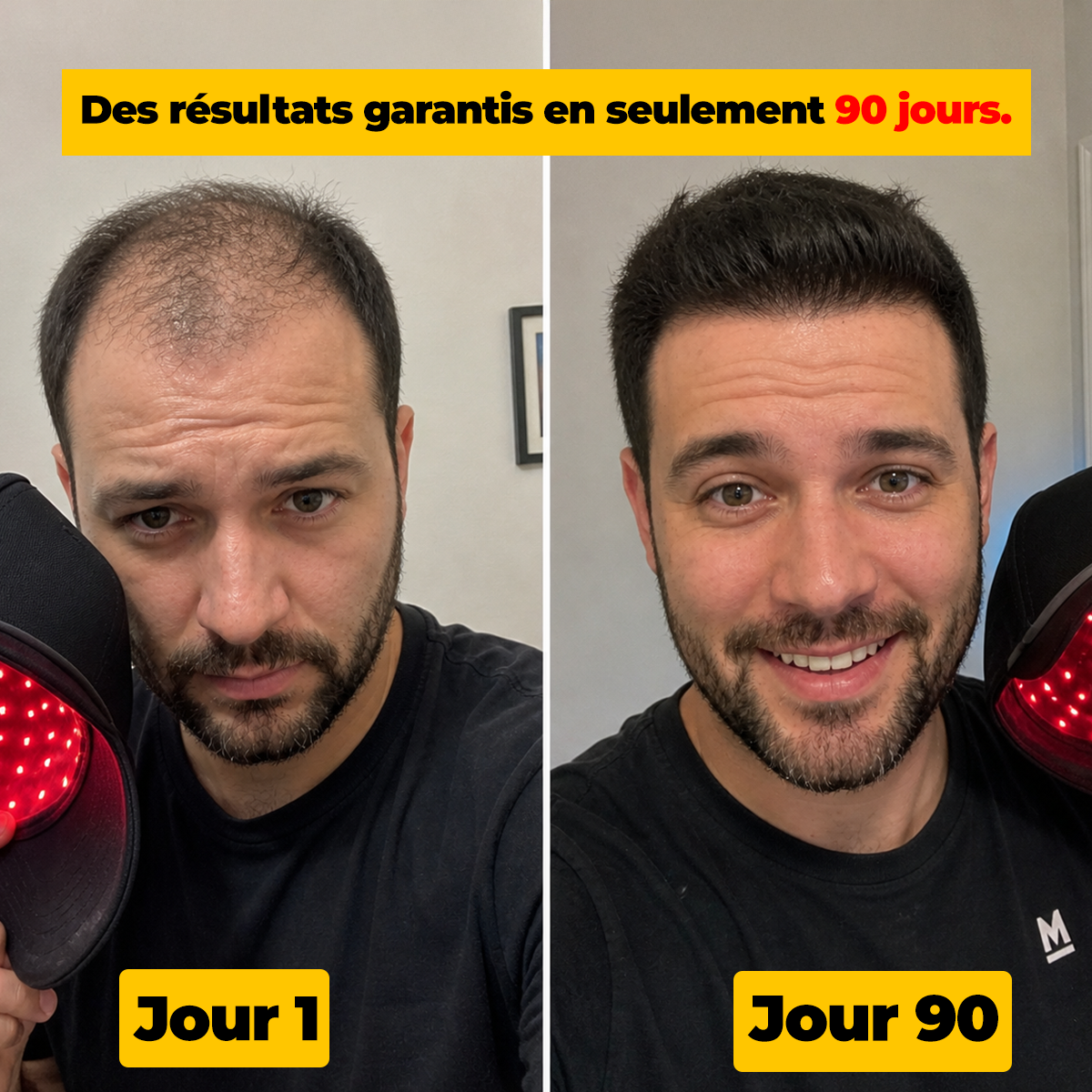 Antes y después HairLux